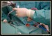 NEUROCHIRURGIE FOTO 23.jpg